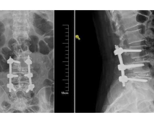 陕西哪家医院可以做试管-陕西哪家医院做试管婴儿最好！