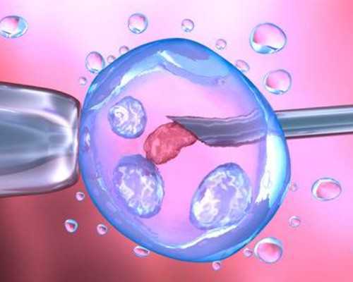 什么是盆腔炎 引发盆腔炎的四大原因